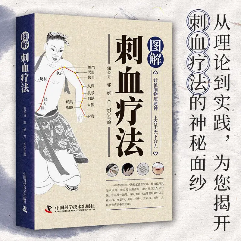 Bloodletting Therapy Explained - Therapy Health And Wellness ulasan dan harga